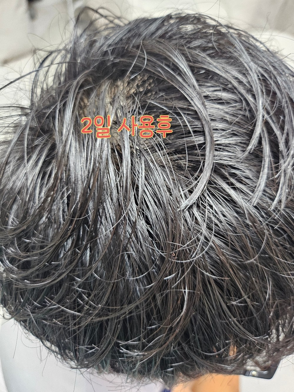 지루성 두피 특허성분 비듬 각질 케어 모모쿨 님트리 약산성 구매 후기 이미지