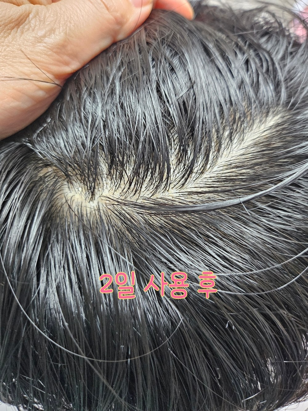 지루성 두피 특허성분 비듬 각질 케어 모모쿨 님트리 약산성 구매 후기 이미지